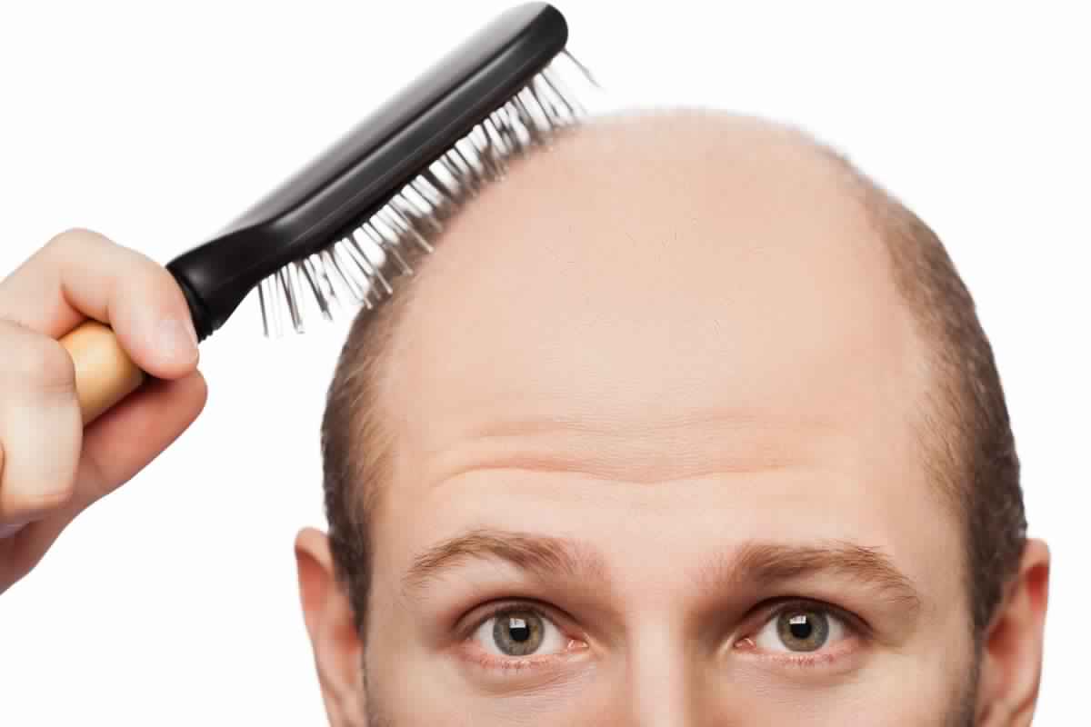 7  طرق لزراعة الشعر الطبيعي